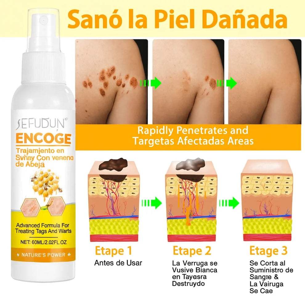 Tag Recede™ Spray Eliminador de Verrugas