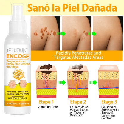 Tag Recede™ Spray Eliminador de Verrugas