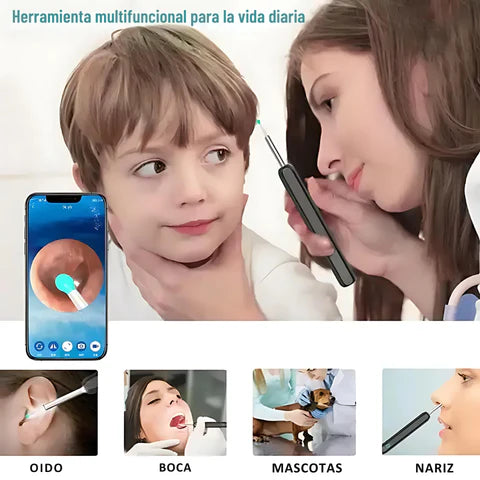 Smartbud - LIMPIADOR DE OÍDO CON CÁMARA 4K📸