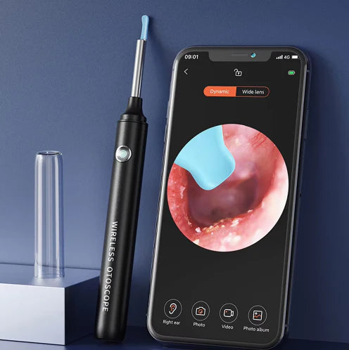 Smartbud - LIMPIADOR DE OÍDO CON CÁMARA 4K📸