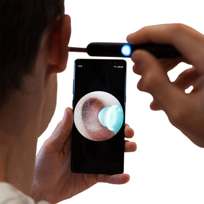 Smartbud - LIMPIADOR DE OÍDO CON CÁMARA 4K📸
